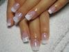  Top'ongle